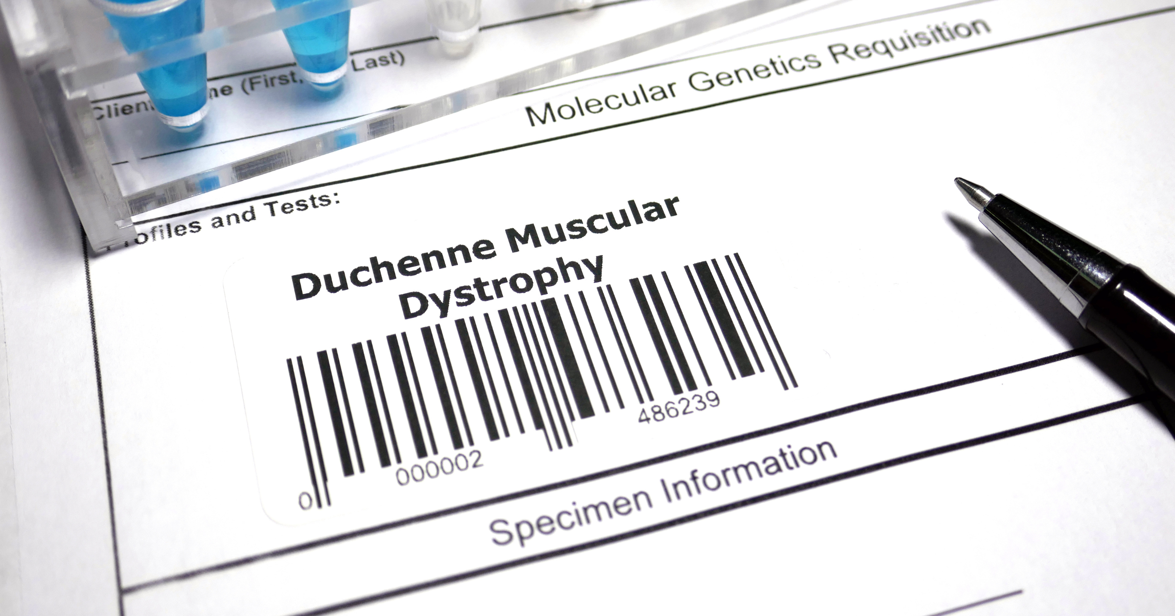 Distrofia muscular de Duchenne